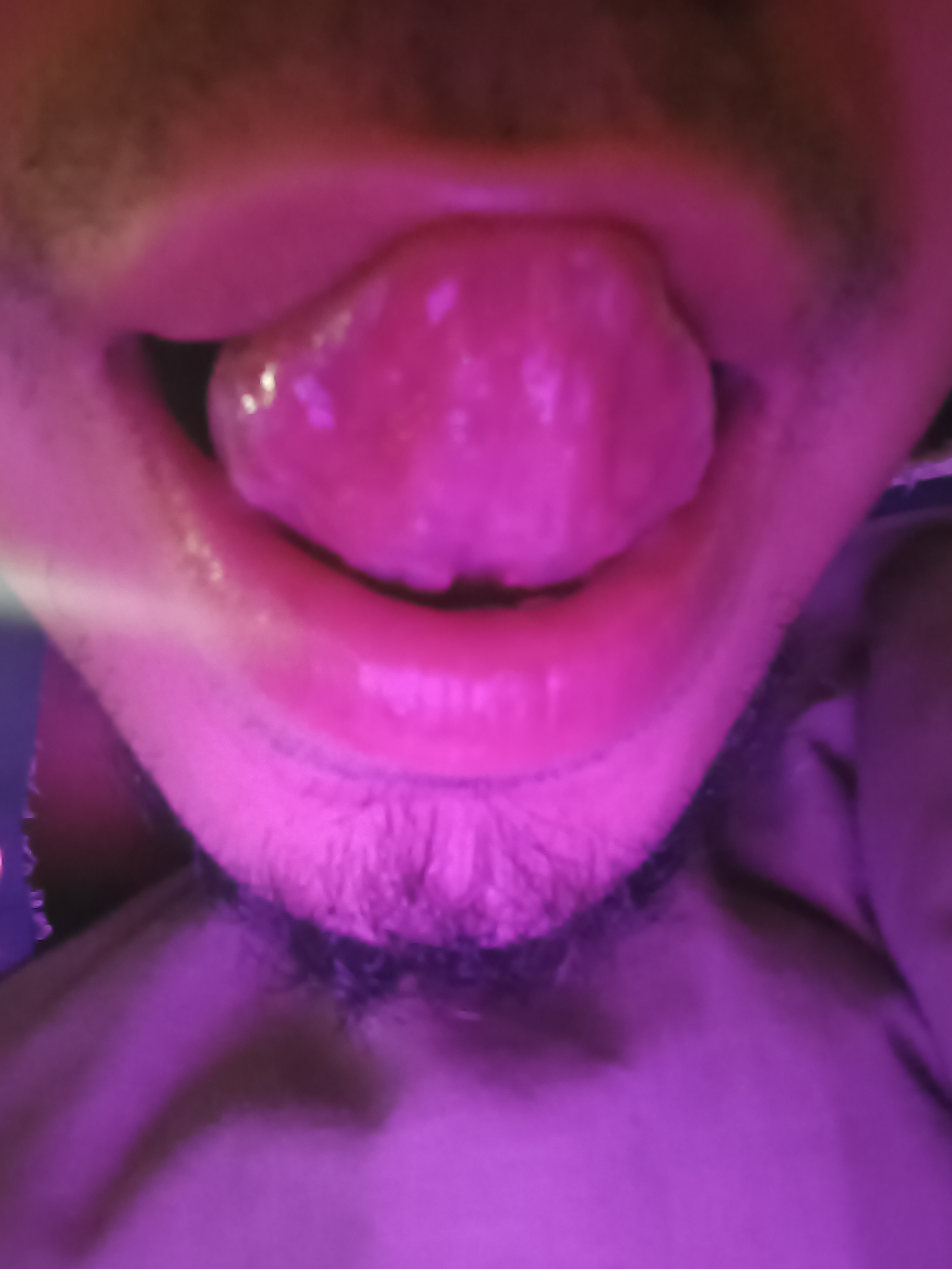 Hotrodz